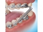 Preview: Forsus™ Class II Corrector, L-Pin Module, 1-Patient-Kit, Push Rod Large (32 mm)