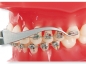 Preview: Pensa pentru tubusoare ortodontice